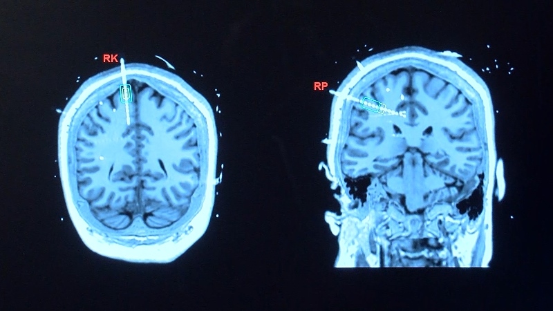 Medical image of the brain