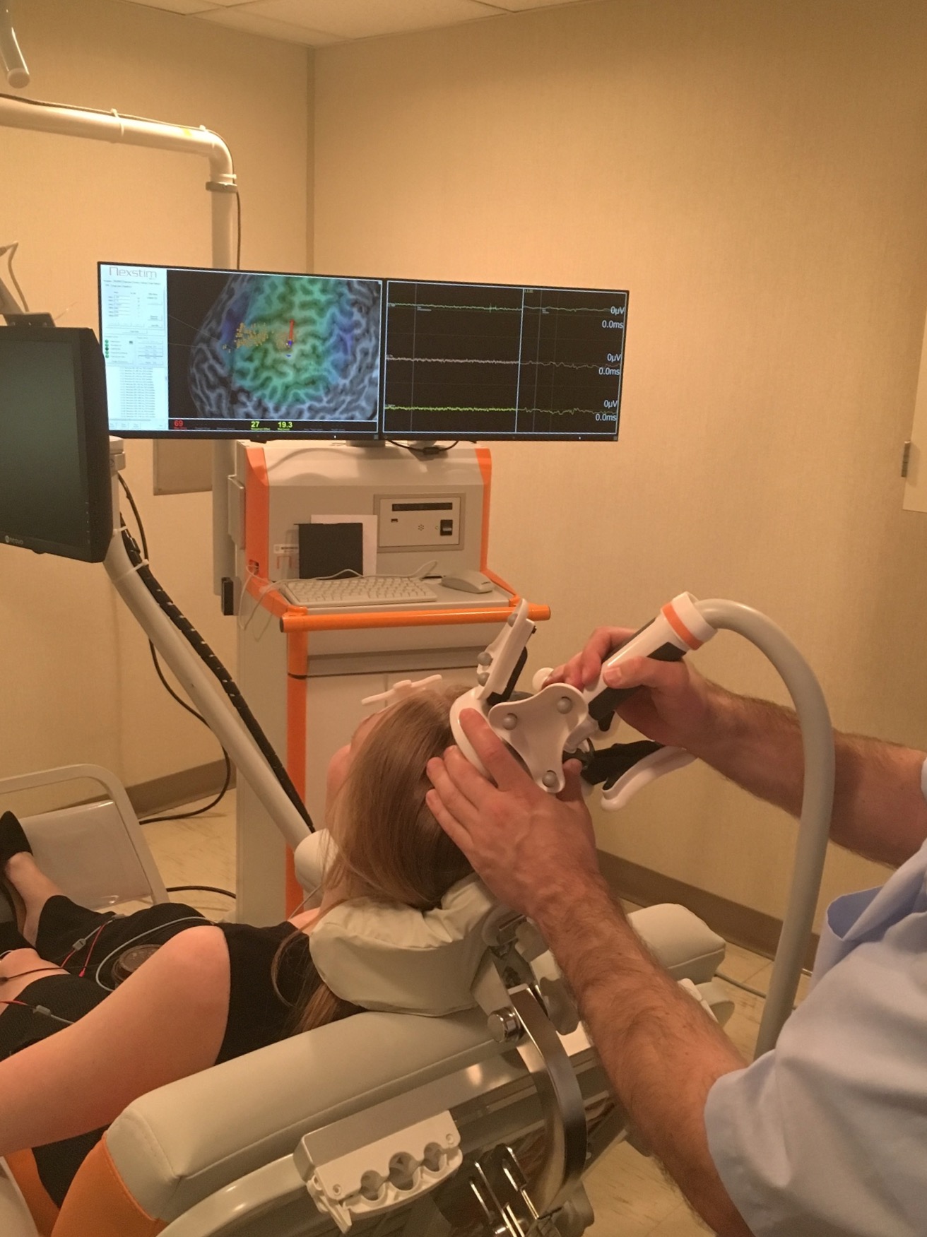 brain-stimulation-for-epilepsy-epilepsy-foundation-of-minnesota
